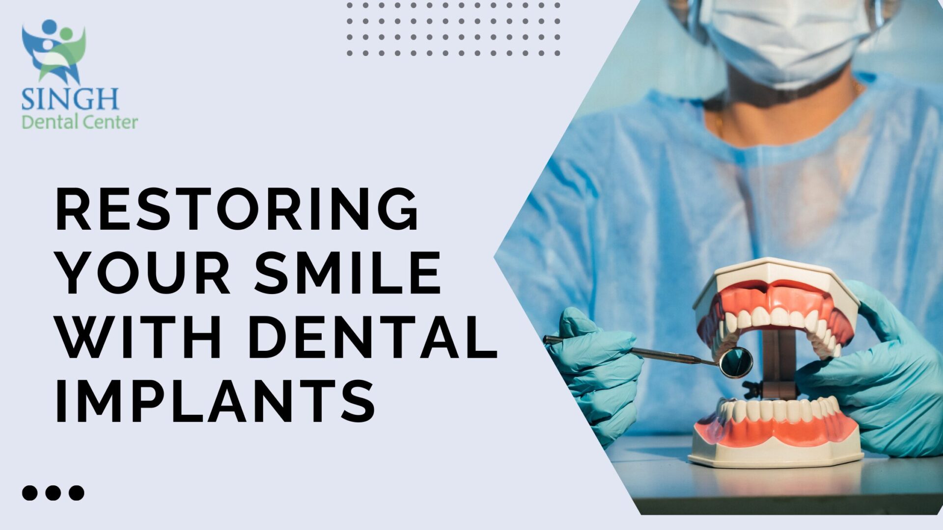 A dentist showing a dental implant on a model of teeth with the blog title and a “Read More” button.